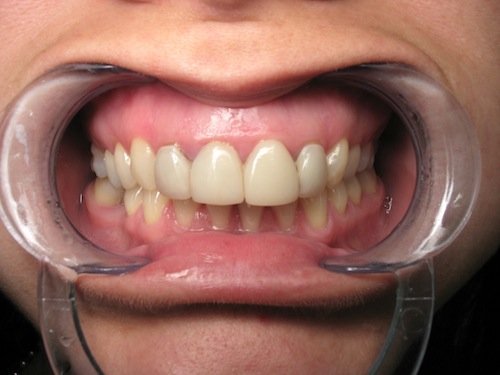 cerec santaella